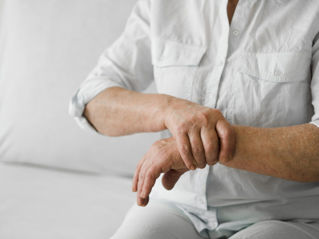 mulher com artrite nas mãos