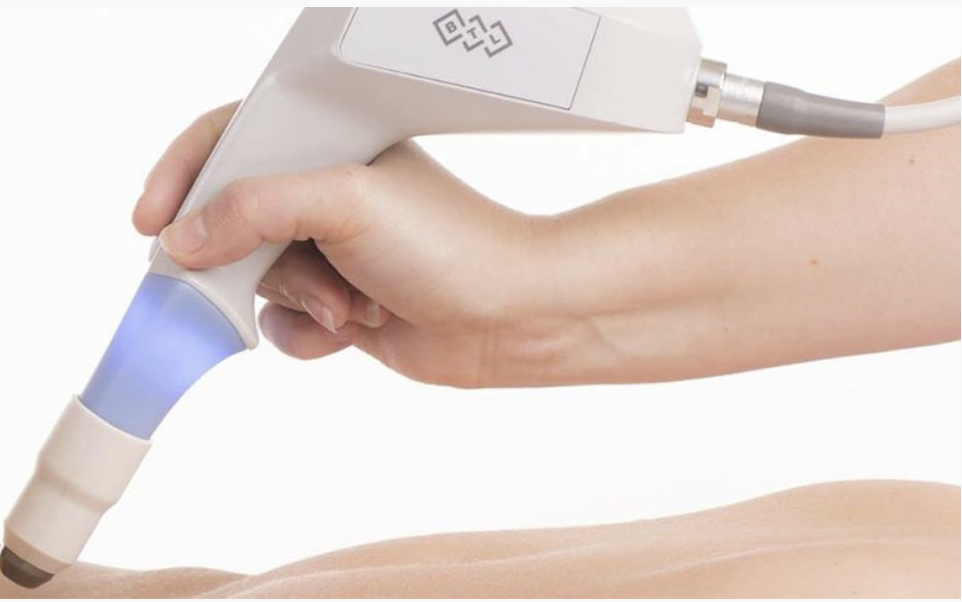 aparelho de laser íntimo passando na pele da paciente